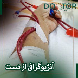 آنژیوگرافی از دست چیست و چگونه انجام میشود؟