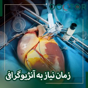 چه زمانی آنژیوگرافی لازم است؟