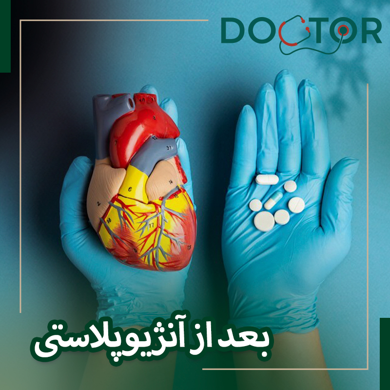 ریکاوری بعد از آنژیوپلاستی و استنت‌گذاری قلب