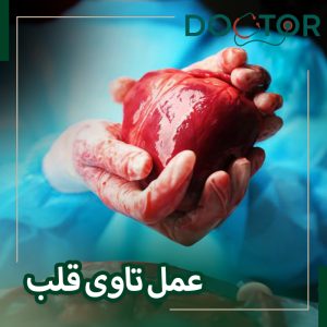 عمل تاوی قلب Tavi چیست؟