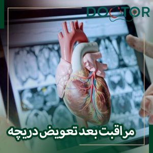 مراقبت بعد از عمل تعویض دریچه قلب