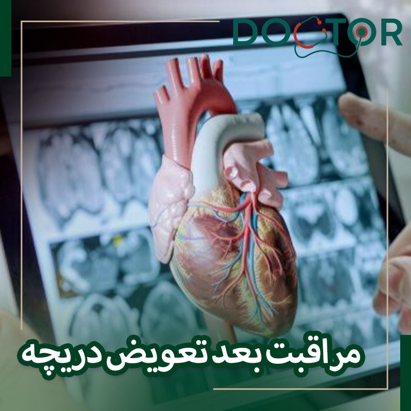 مراقبت بعد از عمل تعویض دریچه قلب