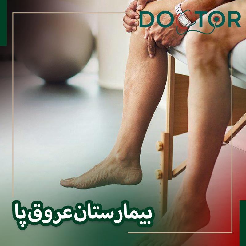 بیمارستان عروق پا در شرق تهران با تجهیزات پیشرفته