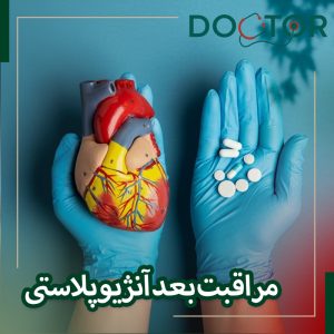 مراقبت های پس از آنژیوپلاستی