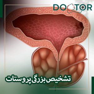 تشخیص بزرگی پروستات