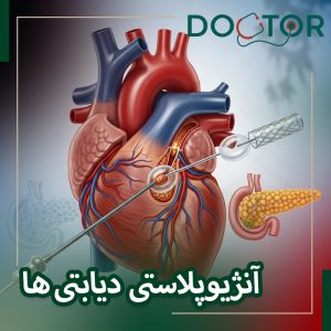 آنژیوپلاستی در بیماران دیابتی