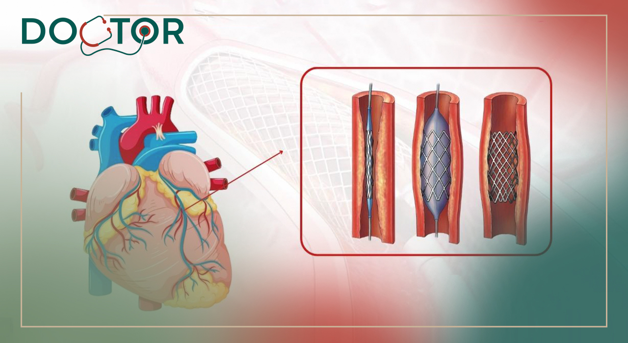 هدف آنژیوگرافی و آنژیوپلاستی با یکدیگر چه تفاوت هایی دارد؟