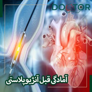 آمادگی‌های قبل از آنژیوپلاستی
