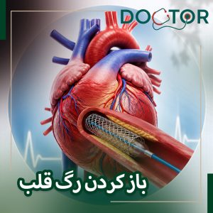 باز کردن رگ قلب بدون عمل قلب باز