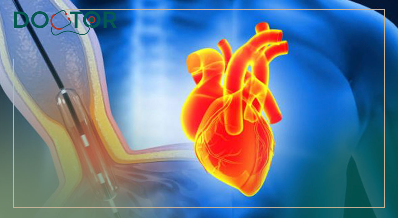 اصطلاحات رایج در جواب آنژیوگرافی