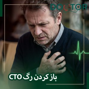 باز کردن رگ CTO